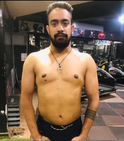 Shivank Chopra before transformation